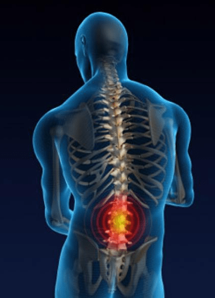 5 Natural Ways To Relieve Lower Back Pain