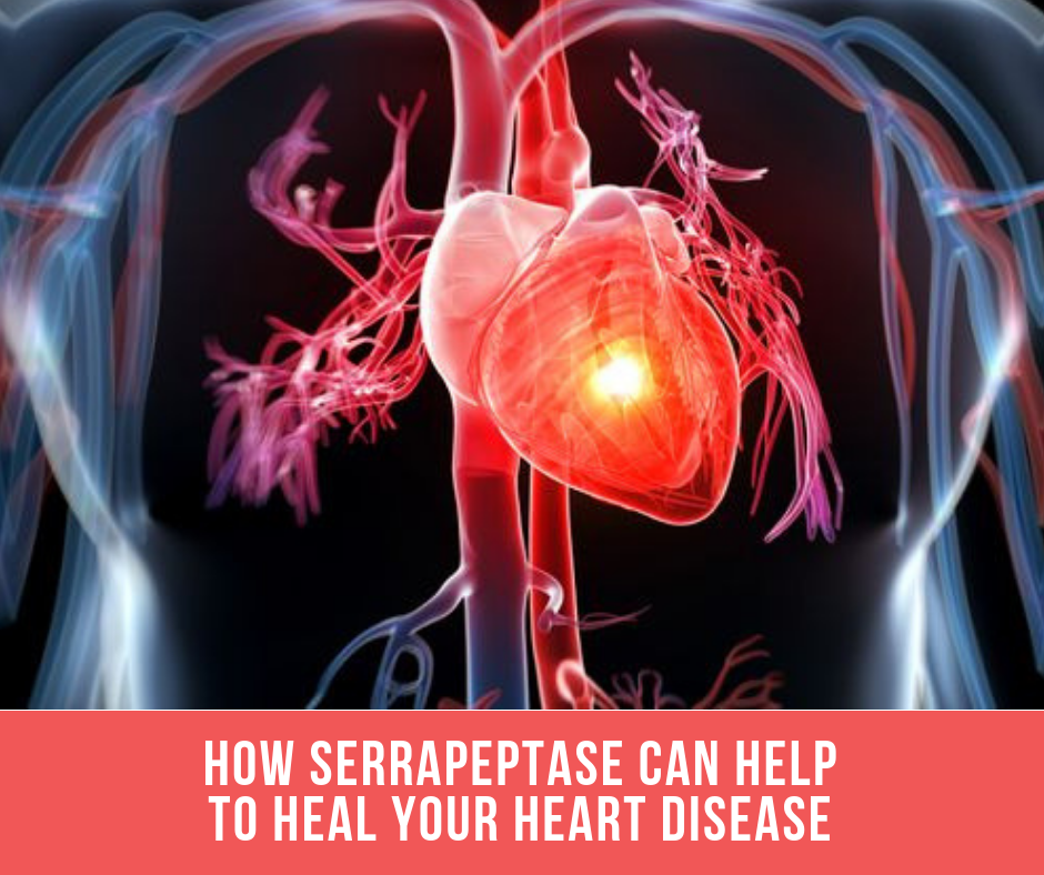 How Serrapeptase Can Help To Heal Your Heart Disease